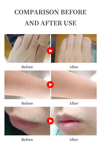 2025 Professional 808nm Epilator 4000W Painless Ice Platinum Diode Laser Hair Removal Machine 4 Wavelength Home Use And Salon