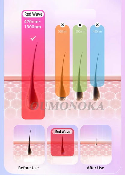 999999 Flashes IPL Laser Epilator for Women Home Use Devices Hair Removal Painless Electric Epilator Bikini Dropshipping