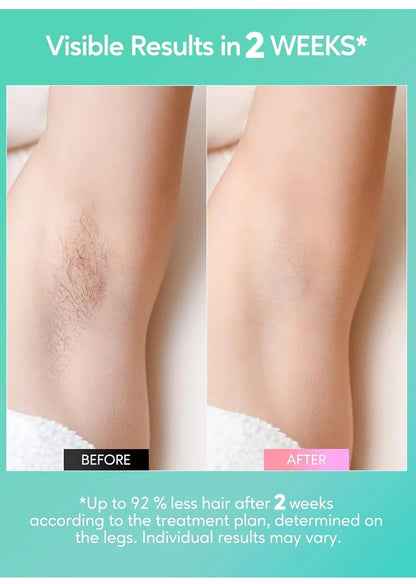 999999 Flashes IPL Laser Epilator for Women Home Use Devices Hair Removal Painless Electric Epilator Bikini Dropshipping