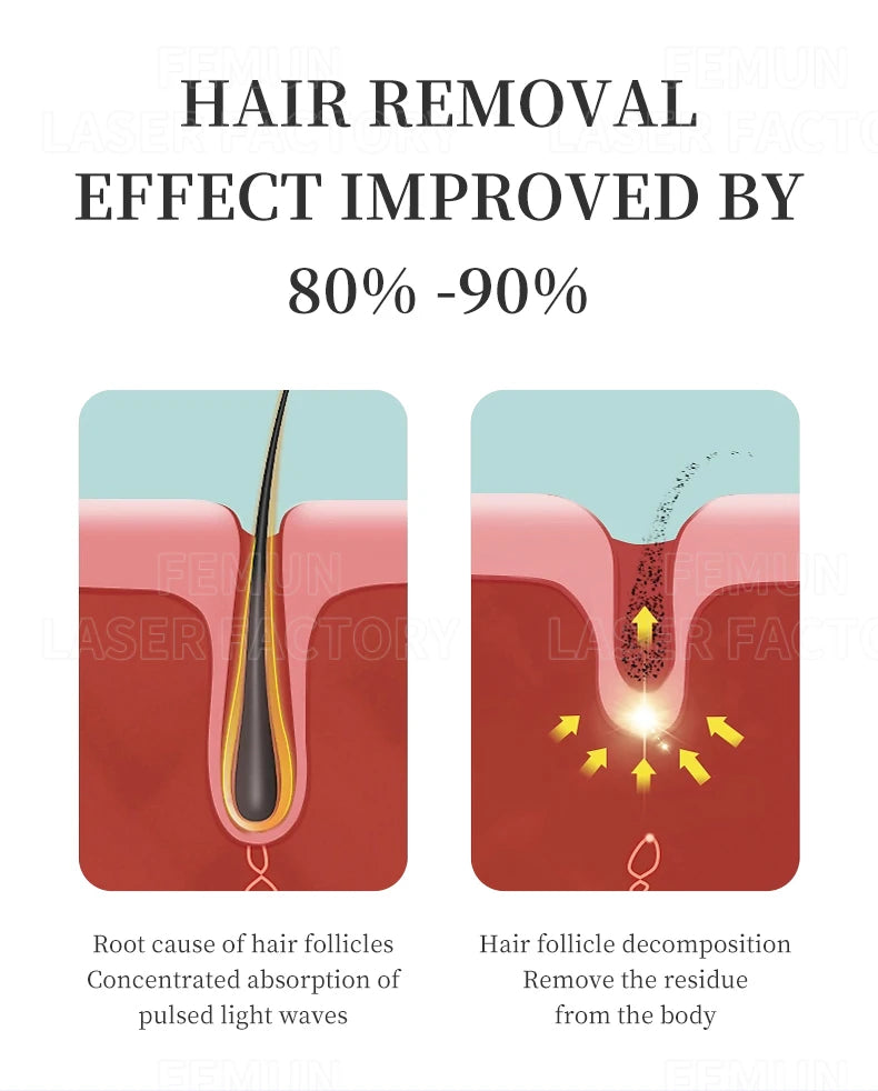 2025 Professional 808nm Epilator 4000W Painless Ice Platinum Diode Laser Hair Removal Machine 4 Wavelength Home Use And Salon