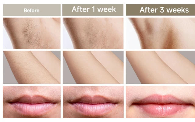 999999 Flashes IPL Laser Epilator for Women Home Use Devices Hair Removal Painless Electric Epilator Bikini Dropshipping