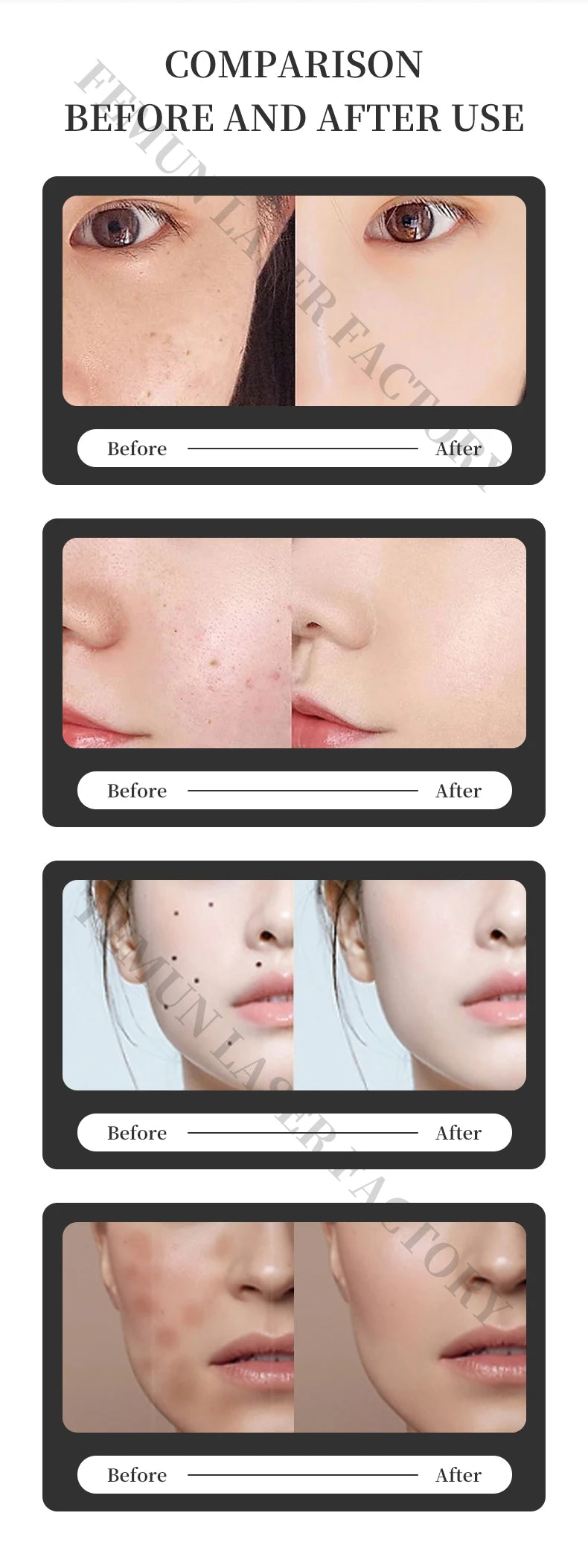 2025 Professional 808nm Epilator 4000W Painless Ice Platinum Diode Laser Hair Removal Machine 4 Wavelength Home Use And Salon